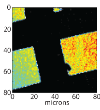 Confocal image.
